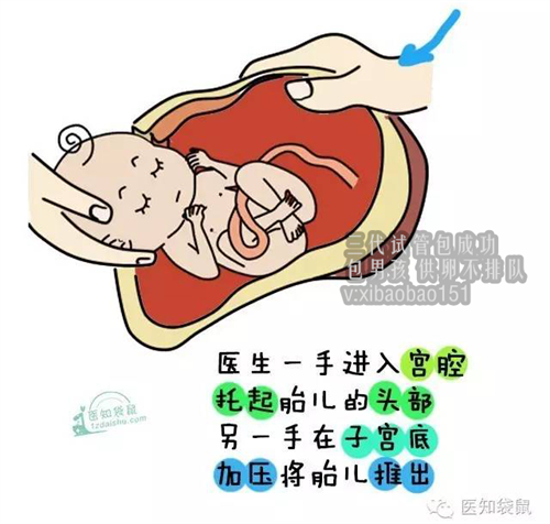 靠谱北京代怀孕保密咨询,卵巢早衰可以吃促排卵药吗